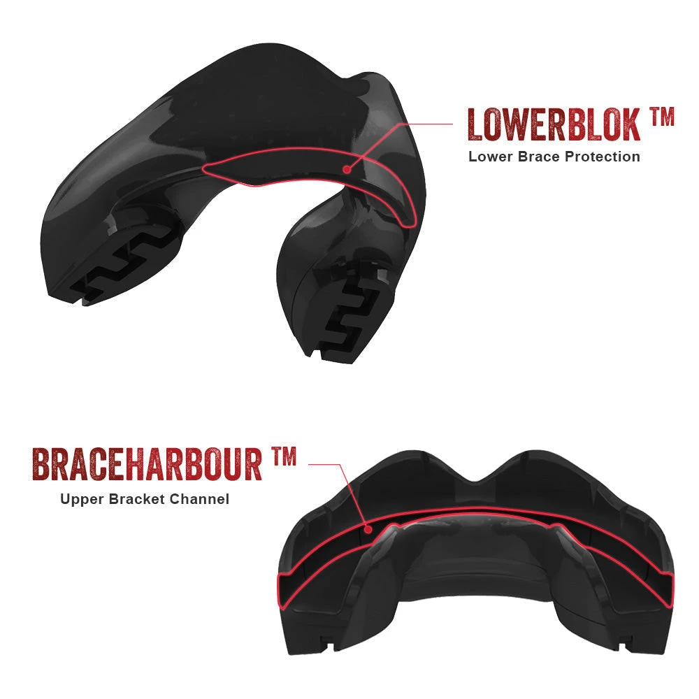 SAFE JAWZ SAFEJAWZ Ortho Mouthguard For Braces - Black 7 SAFE JAWZ SAFEJAWZ Ortho Mouthguard For Braces - Black